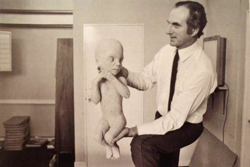 The &Amp;Quot;Star Child&Amp;Quot;: Dullea'S Character Is Transformed Into This Open-Eyed Fetus At The End Of The Film.